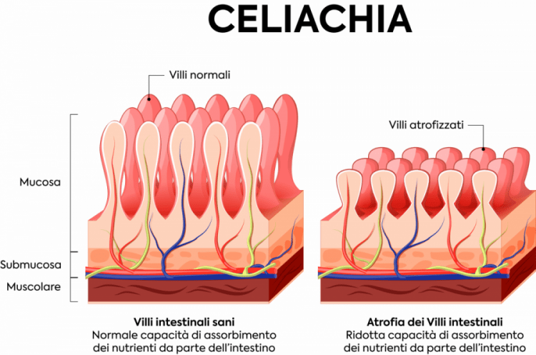 bonus celiachia bonus celiachia,negozio senza glutine,laboratorio senza glutine,senza glutine,celiachia http://ricetteintolleranti.it/wp-content/uploads/2019/07/cropped-senza-glutine-LOGO-04.jpg